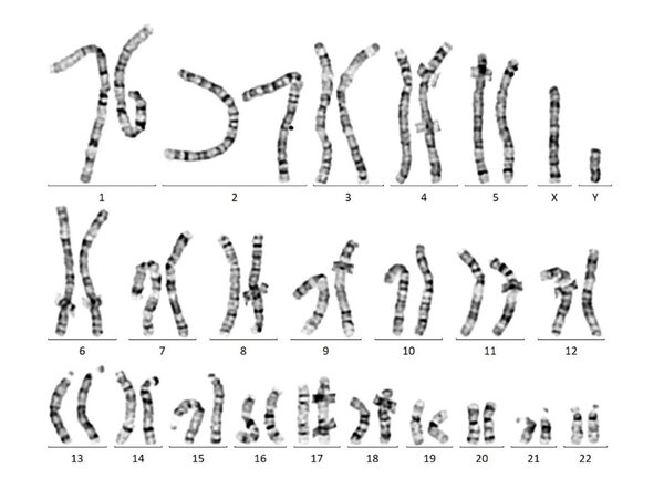 unauffälliger männlicher Chromosomensatz 46,XY , Bandenauflösung ca. 550 bphs